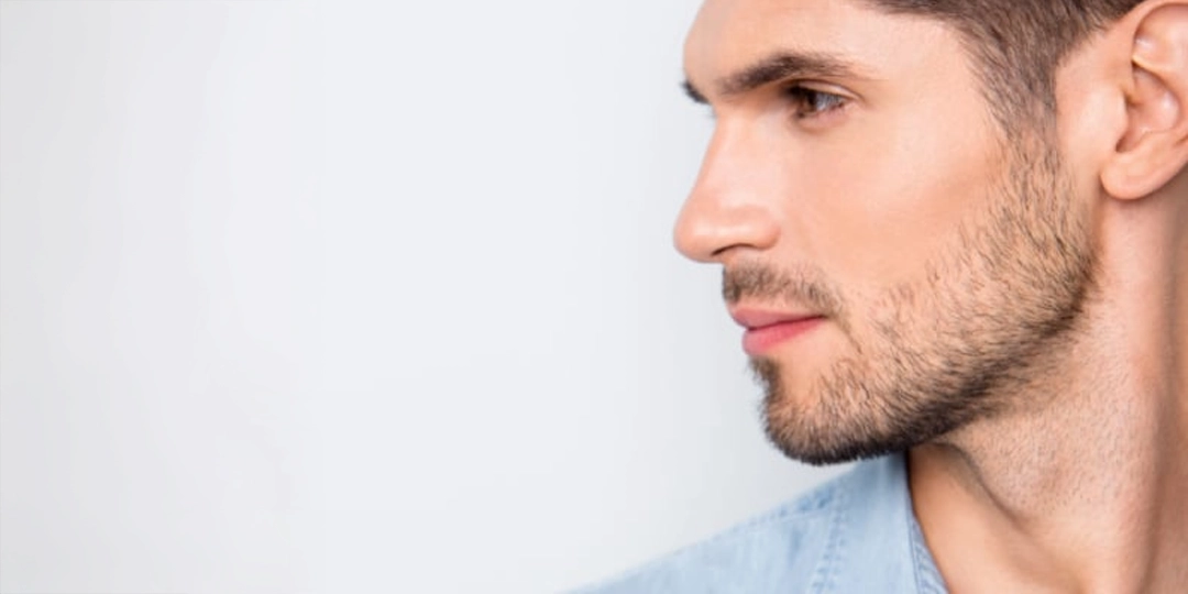 Beneficios del aumento de mentón con ácido hialurónico