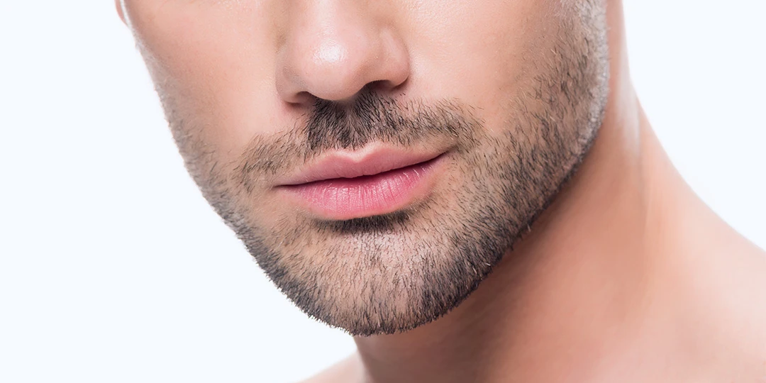 Cómo es el procedimiento de aumento de mentón con ácido hialurónico